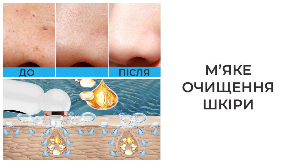 Апарат для вакуумного чищення пор обличчя (8653)