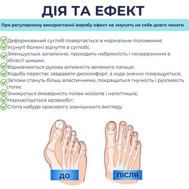 Тренажер выпрямитель для больших пальцев ног при вальгусе (8939)